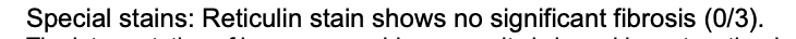 Special stains: Reticulin stain shows no significant fibrosis (0/3).